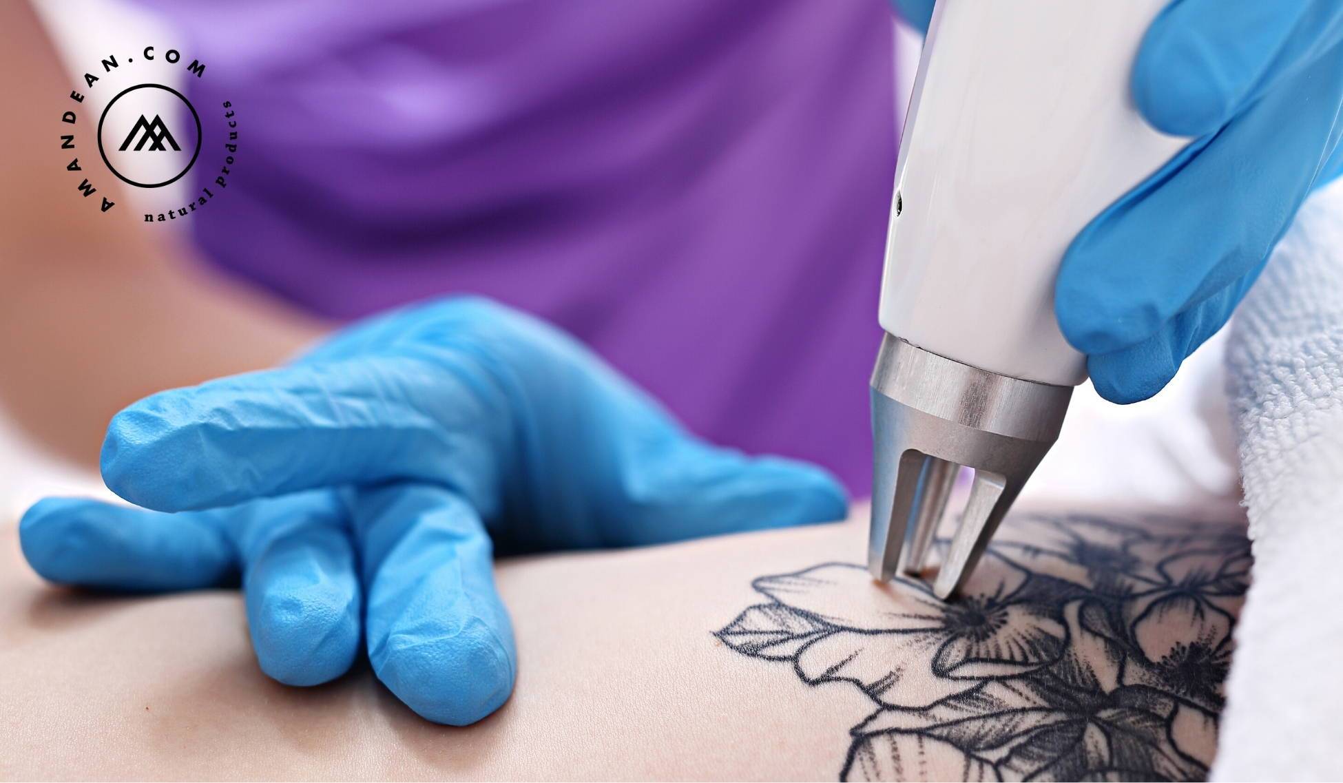 The Complete Laser Tattoo Removal Aftercare Routine